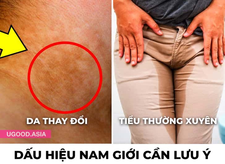 14 Triệu Chứng Sức Khỏe Nam Giới Không Nên Bỏ Qua Mà Hãy Kiểm Tra Định Kì Và Đừng Trì Hoãn Hỗ Trợ Y Tế