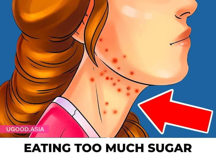 8 Signs You Are Eating Too Much Sugar And This is Affect Your Body