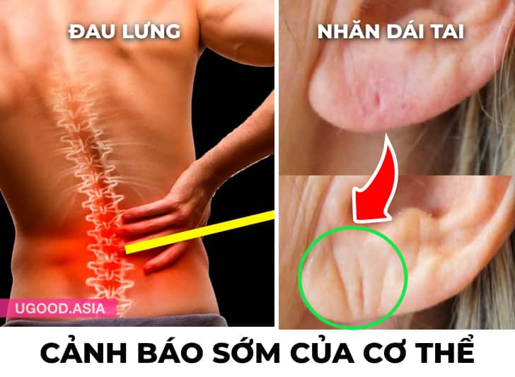 14 Dấu Hiệu Cảnh Báo Sớm Cơ Thể Mách Bảo Bạn Về Các Vấn Đề Sức Khoẻ Hoặc Các Căn Bệnh Nghiêm Trọng