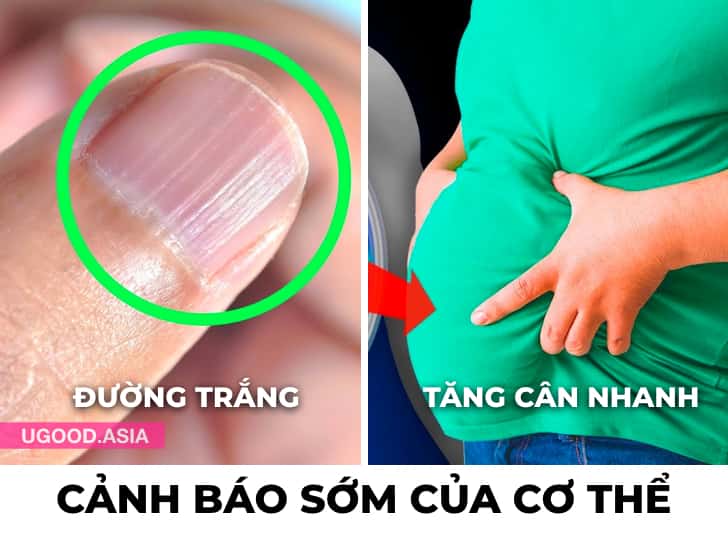 14 Dấu Hiệu Cảnh Báo Sớm Cơ Thể Mách Bảo Bạn Về Các Vấn Đề Sức Khoẻ Hoặc Các Căn Bệnh Nghiêm Trọng